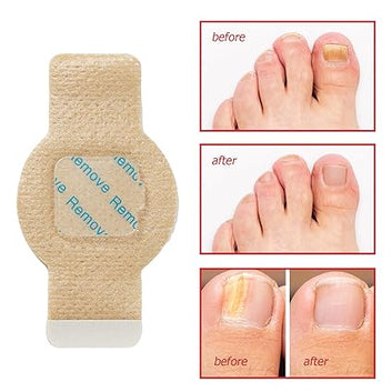 21 PCS Antifungal Nail Treatment Patches | Advanced Nail Repair for Damaged, Cracked & Discolored Nails