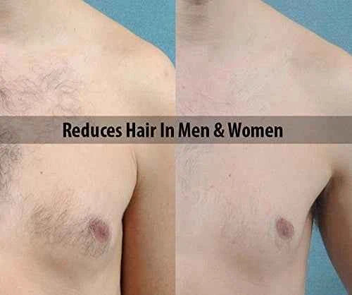 Hair Growth Removal Inhibitor Serum Oil Body & Face Hair Ant Egg Oil Made UK