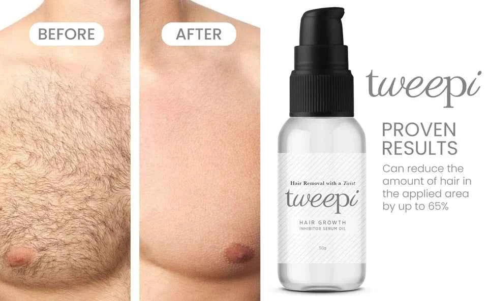 Hair Growth Removal Inhibitor Serum Oil Body & Face Hair Ant Egg Oil Made UK